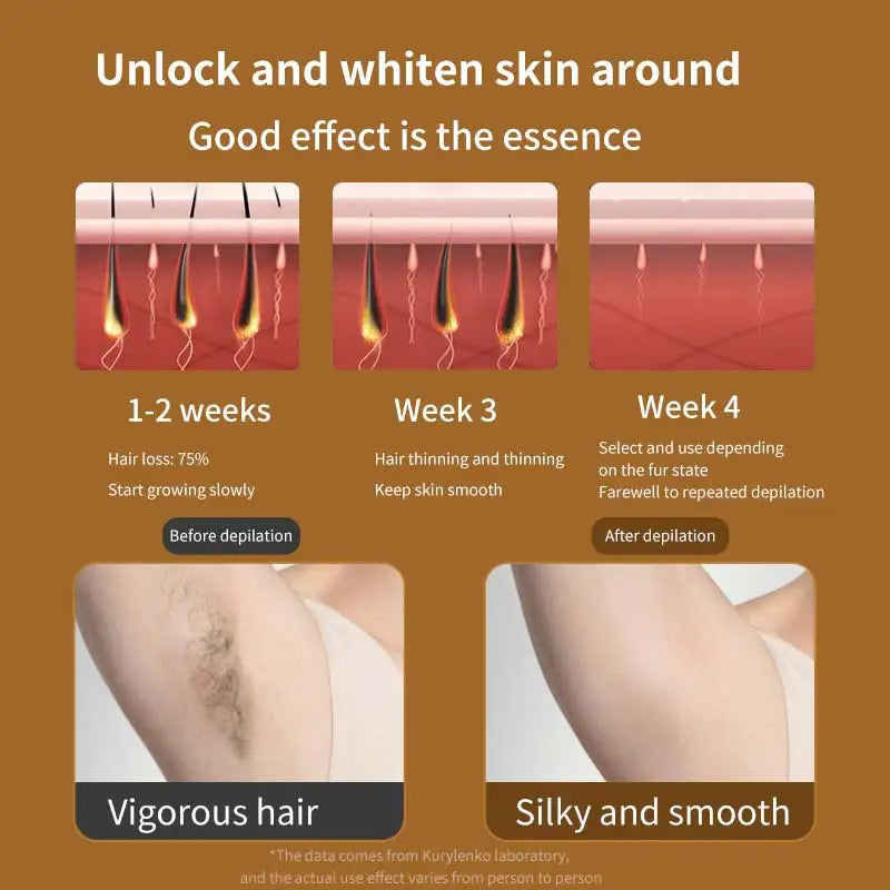 Visage LumiCool IPL Laser Hair Removal