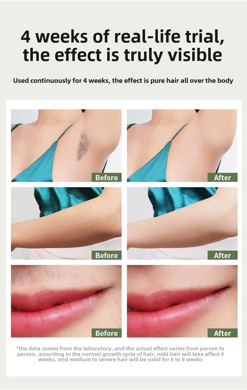 Visage LumiCool IPL Laser Hair Removal