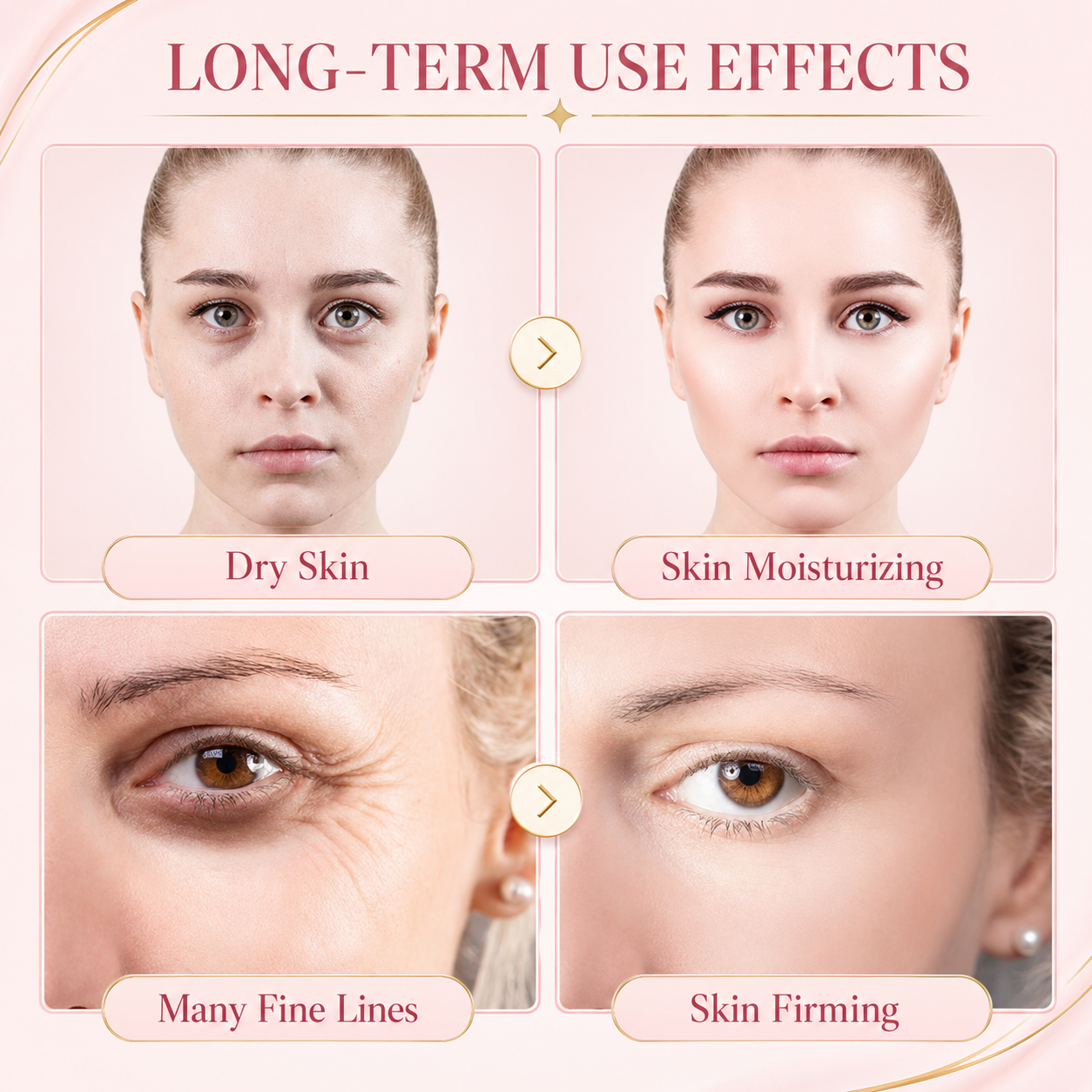 Visage Portable HIFU