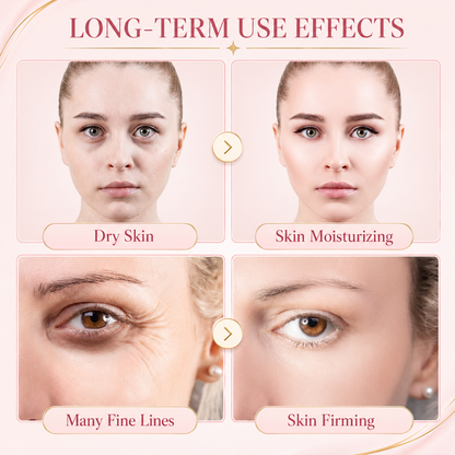 Visage Portable HIFU