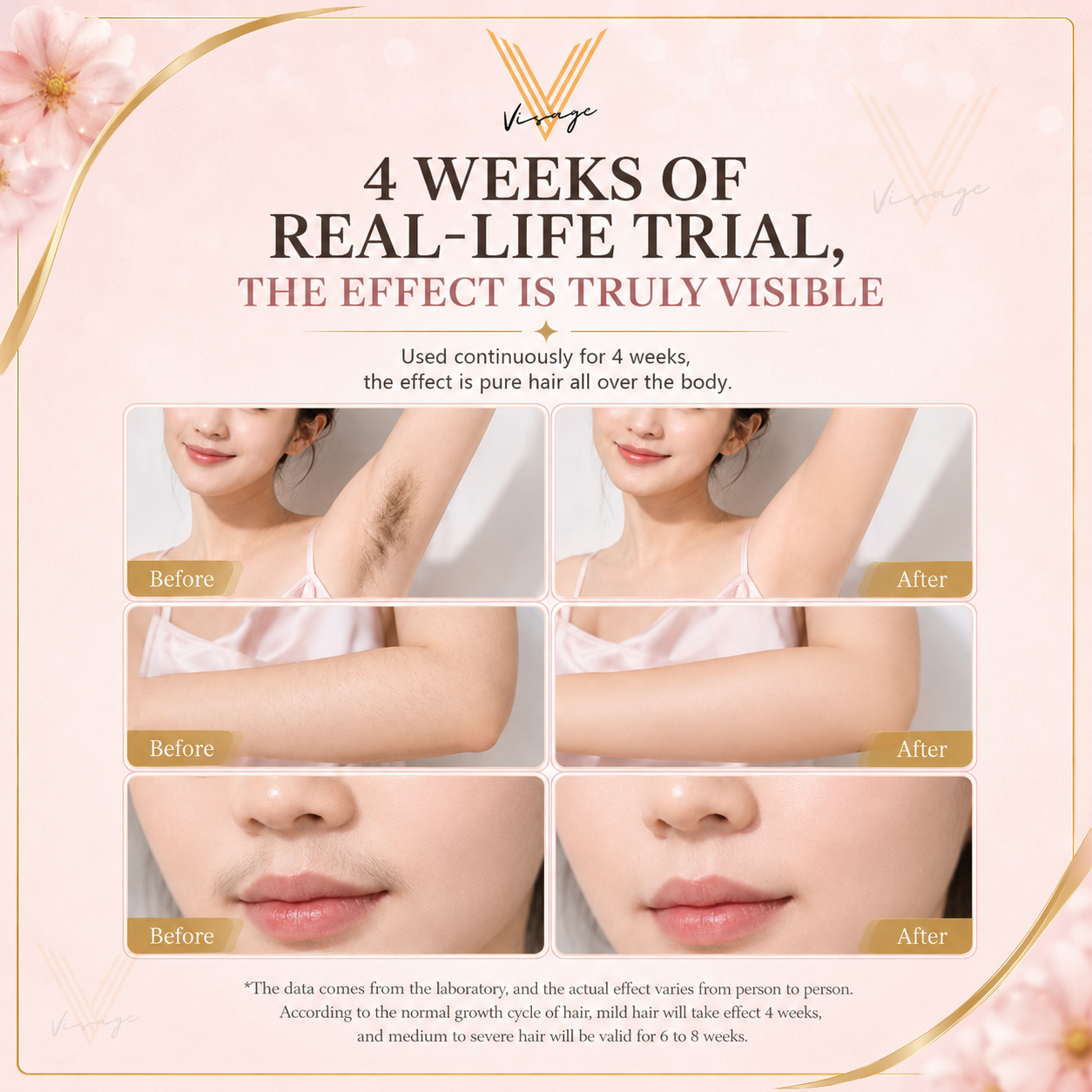 Visage LumiCool IPL Laser Hair Removal