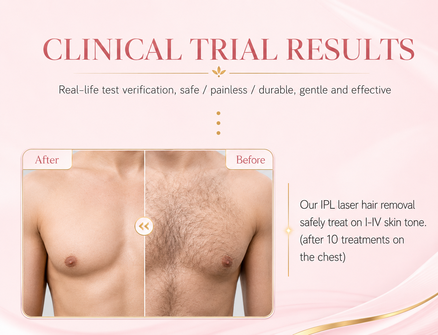 Visage IPL Laser Hair Removal Device