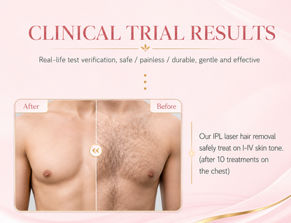 Visage IPL Laser Hair Removal Device
