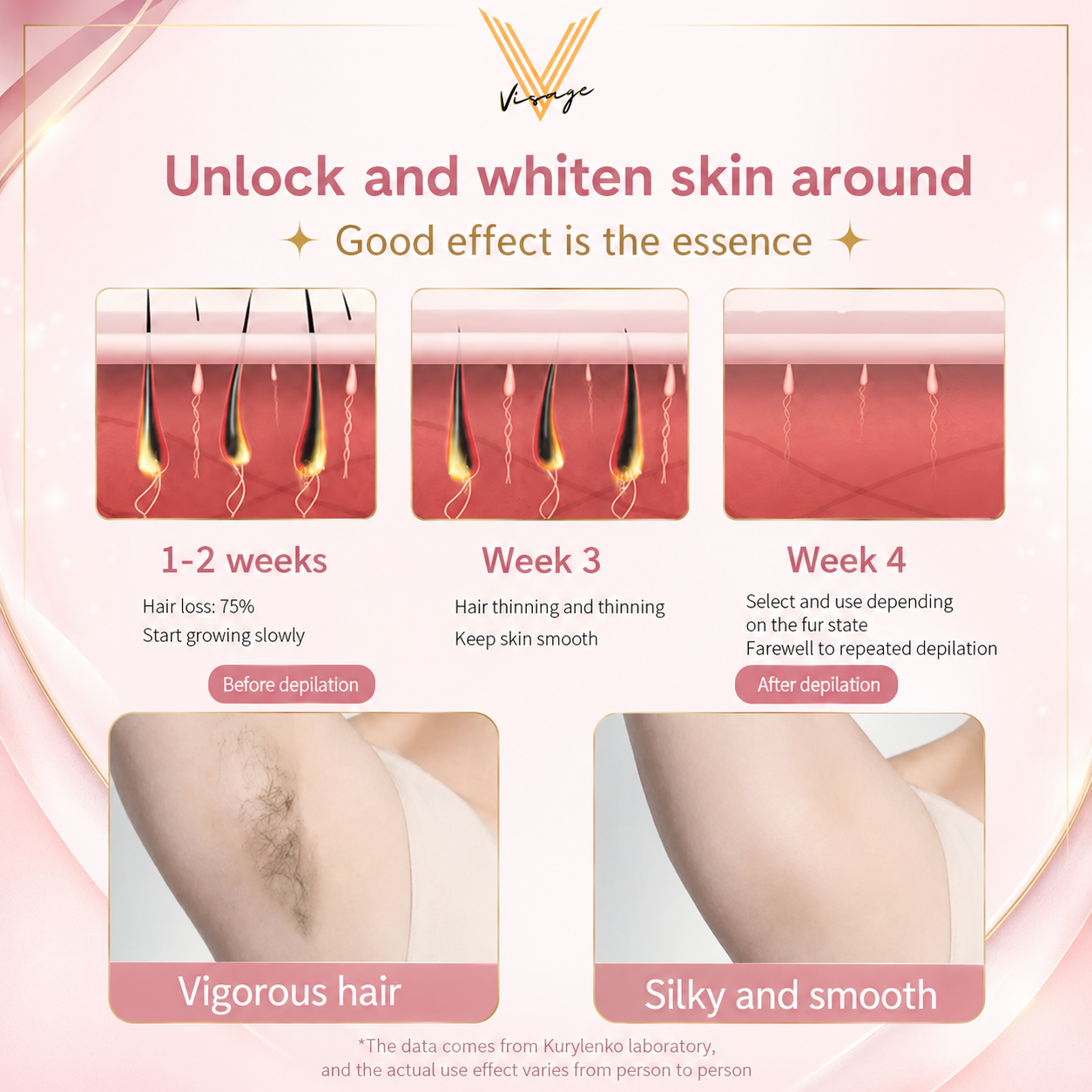 Visage LumiCool IPL Laser Hair Removal